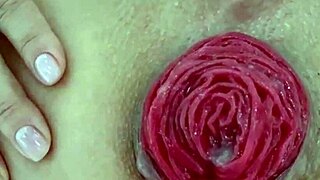 whoa, check this destroyed anal prolapse up close!