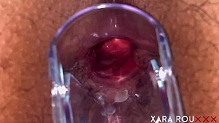 Anal speculum reveals gaping BBW ass wide open 😏