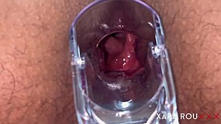 Anal speculum reveals gaping BBW ass wide open 😏