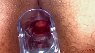 Anal speculum reveals gaping BBW ass wide open 😏