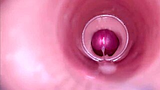 Weibliche Insemination mit interner Kamera bei tiefer Ejakulation